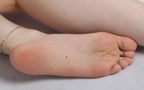 女人左脚底有痣好不好 代表什么