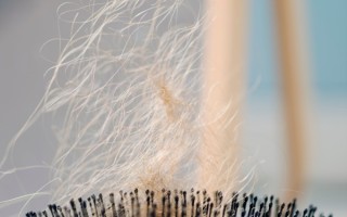 种植头发可以保持几年？种植头发的长期效果